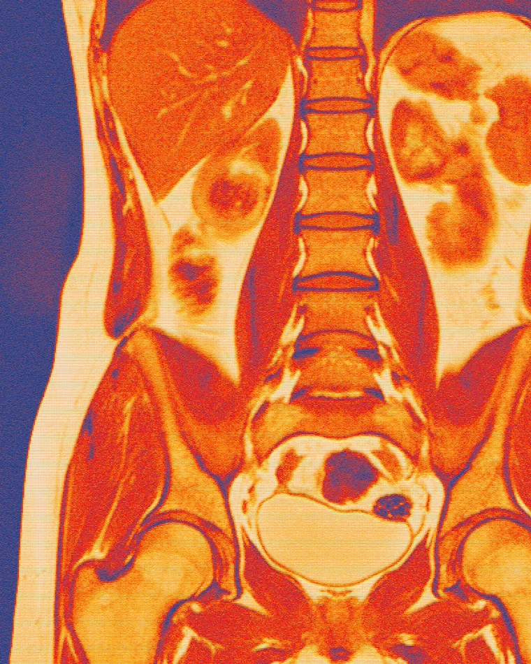 MiXray radiology clinic website design